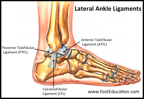 Ankle Instability